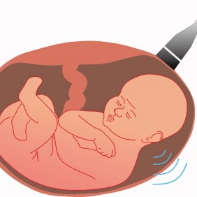 Hamilelikte Nefes Darlığı Yaşamak