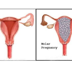 Menopozda Yapılan Hormon Testleri