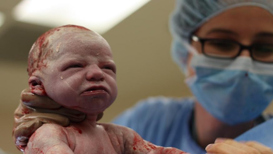 Sezaryen Doğum Zor Bir Operasyon mu?