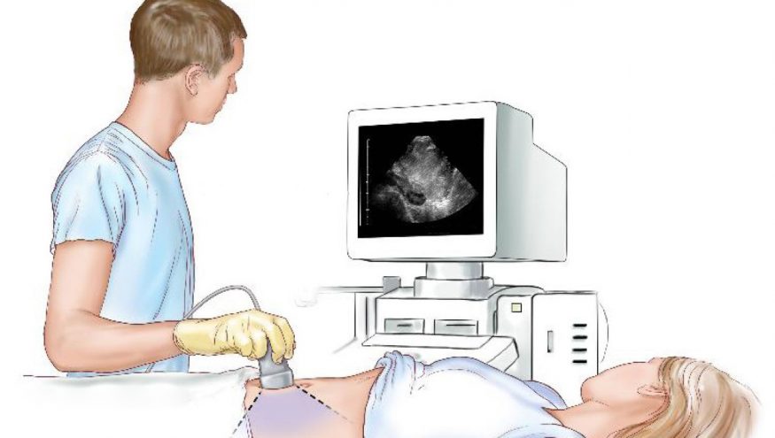 EUS (Endoskopik Ultrason) nedir? | Tanı ve Tedavi Avantajları