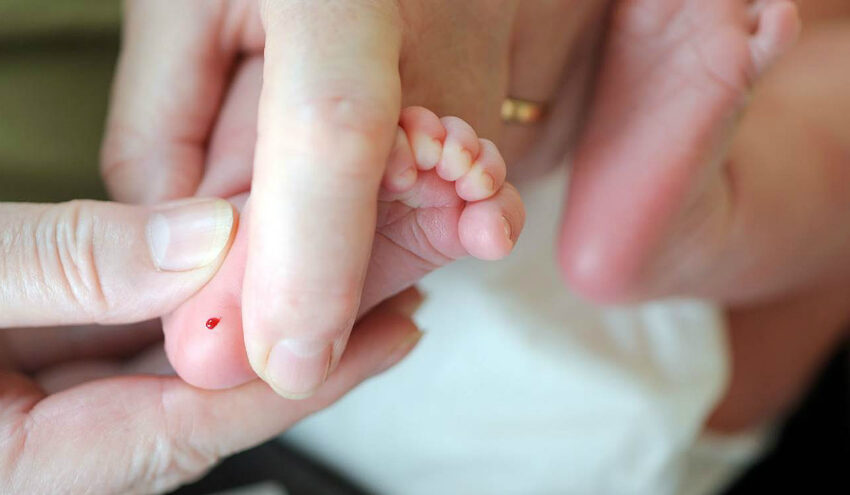 Bebeklerde Neden Topuk Kanı Alınır?